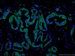 PADI2 Rabbit anti-Human, Mouse, Rat, Polyclonal, Proteintech:Antibodies:Primary