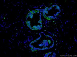 PADI2 Rabbit anti-Human, Mouse, Rat, Polyclonal, Proteintech:Antibodies:Primary