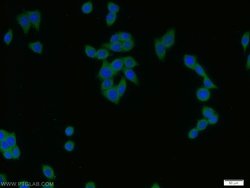 PADI2 Rabbit anti-Human, Mouse, Rat, Polyclonal, Proteintech:Antibodies:Primary