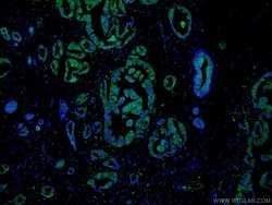 PADI2 Rabbit anti-Human, Mouse, Rat, Polyclonal, Proteintech:Antibodies:Primary