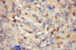 PADI2 Rabbit anti-Human, Mouse, Rat, Polyclonal, Proteintech:Antibodies:Primary