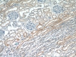 PADI2 Rabbit anti-Human, Mouse, Rat, Polyclonal, Proteintech:Antibodies:Primary