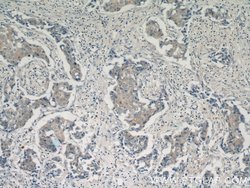 PADI2 Rabbit anti-Human, Mouse, Rat, Polyclonal, Proteintech:Antibodies:Primary