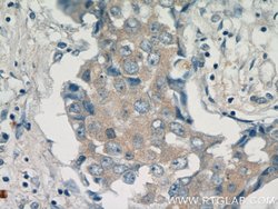 PADI2 Rabbit anti-Human, Mouse, Rat, Polyclonal, Proteintech:Antibodies:Primary