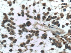 PADI2 Rabbit anti-Human, Mouse, Rat, Polyclonal, Proteintech:Antibodies:Primary
