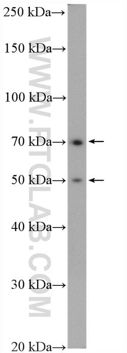 PADI2 Rabbit anti-Human, Mouse, Rat, Polyclonal, Proteintech:Antibodies:Primary