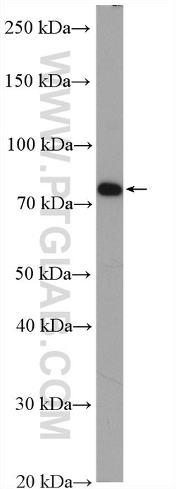 PADI2 Rabbit anti-Human, Mouse, Rat, Polyclonal, Proteintech:Antibodies:Primary