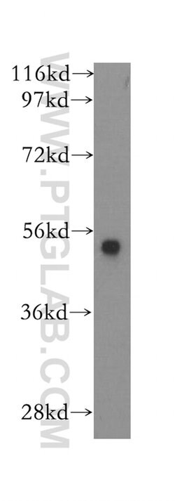 PADI2 Rabbit anti-Human, Mouse, Rat, Polyclonal, Proteintech:Antibodies:Primary