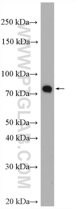 PADI2 Rabbit anti-Human, Mouse, Rat, Polyclonal, Proteintech:Antibodies:Primary