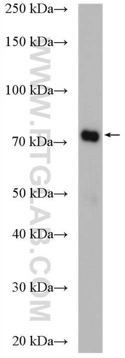 PADI2 Rabbit anti-Human, Mouse, Rat, Polyclonal, Proteintech:Antibodies:Primary