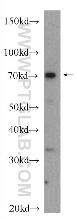PADI2 Rabbit anti-Human, Mouse, Rat, Polyclonal, Proteintech:Antibodies:Primary