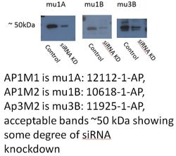 AP1M1 Rabbit anti-Human, Mouse, Rat, Polyclonal, Proteintech:Antibodies:Primary