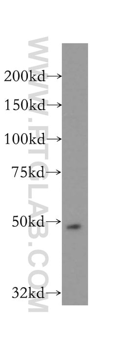 AP1M1 Rabbit anti-Human, Mouse, Rat, Polyclonal, Proteintech:Antibodies:Primary