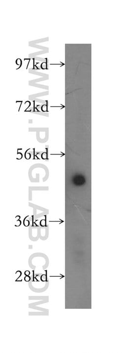 AP1M1 Rabbit anti-Human, Mouse, Rat, Polyclonal, Proteintech:Antibodies:Primary