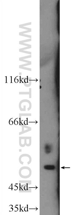 AP1M1 Rabbit anti-Human, Mouse, Rat, Polyclonal, Proteintech:Antibodies:Primary
