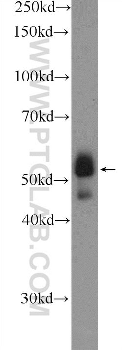 ETS1 Rabbit anti-Human, Mouse, Polyclonal, Proteintech:Antibodies:Primary