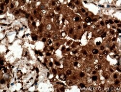 RAD23B Rabbit anti-Human, Mouse, Rat, Polyclonal, Proteintech:Antibodies:Primary