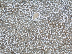 RAD23B Rabbit anti-Human, Mouse, Rat, Polyclonal, Proteintech:Antibodies:Primary