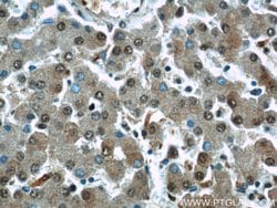 RAD23B Rabbit anti-Human, Mouse, Rat, Polyclonal, Proteintech:Antibodies:Primary
