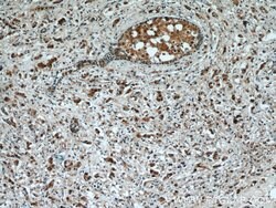 RAD23B Rabbit anti-Human, Mouse, Rat, Polyclonal, Proteintech:Antibodies:Primary