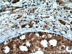 RAD23B Rabbit anti-Human, Mouse, Rat, Polyclonal, Proteintech:Antibodies:Primary