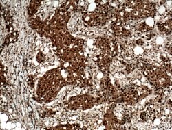 RAD23B Rabbit anti-Human, Mouse, Rat, Polyclonal, Proteintech:Antibodies:Primary