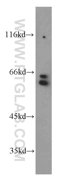 RAD23B Rabbit anti-Human, Mouse, Rat, Polyclonal, Proteintech:Antibodies:Primary
