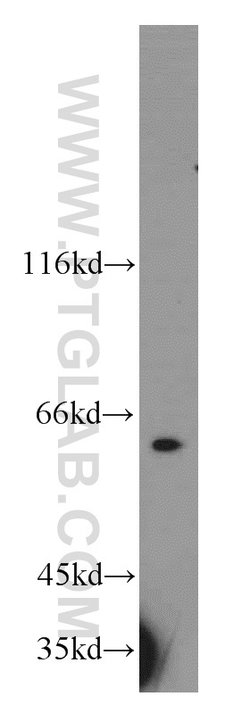 RAD23B Rabbit anti-Human, Mouse, Rat, Polyclonal, Proteintech:Antibodies:Primary