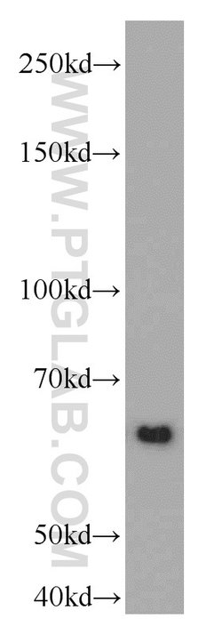 RAD23B Rabbit anti-Human, Mouse, Rat, Polyclonal, Proteintech:Antibodies:Primary