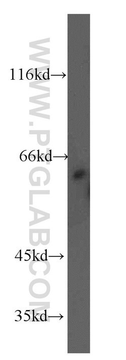 RAD23B Rabbit anti-Human, Mouse, Rat, Polyclonal, Proteintech:Antibodies:Primary