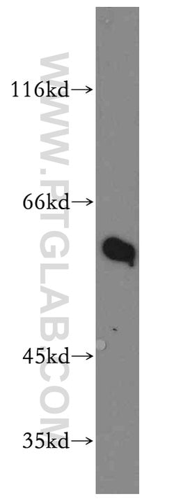 RAD23B Rabbit anti-Human, Mouse, Rat, Polyclonal, Proteintech:Antibodies:Primary