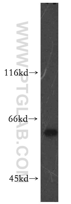 RAD23B Rabbit anti-Human, Mouse, Rat, Polyclonal, Proteintech:Antibodies:Primary