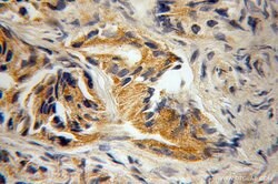 RAB22A Rabbit anti-Human, Polyclonal, Proteintech 150 &mu;L; Unconjugated:Antibodies,