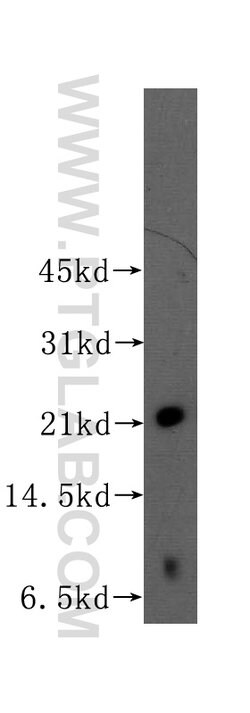 RAB22A Rabbit anti-Human, Polyclonal, Proteintech 150 &mu;L; Unconjugated:Antibodies,