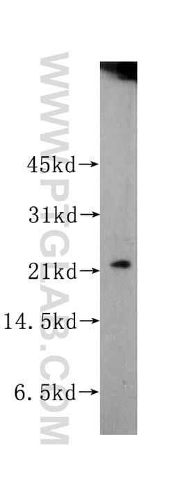 RAB22A Rabbit anti-Human, Polyclonal, Proteintech 150 &mu;L; Unconjugated:Antibodies,