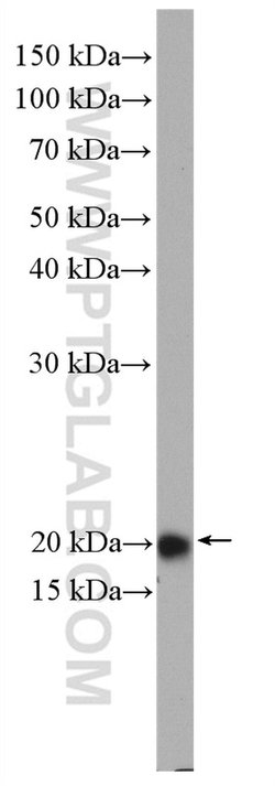RAB22A Rabbit anti-Human, Polyclonal, Proteintech 150 &mu;L; Unconjugated:Antibodies,