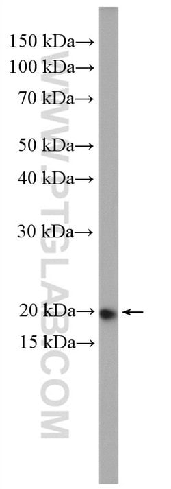 RAB22A Rabbit anti-Human, Polyclonal, Proteintech 150 &mu;L; Unconjugated:Antibodies,