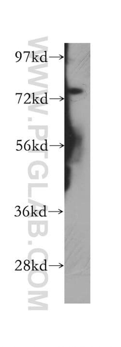 PHF21A Rabbit anti-Human, Mouse, Rat, Polyclonal, Proteintech:Antibodies:Primary