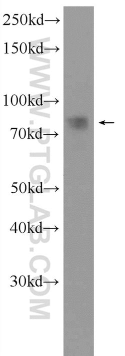 CIN85 Rabbit anti-Human, Mouse, Rat, Polyclonal, Proteintech 150 &mu;L;