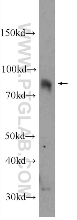 CIN85 Rabbit anti-Human, Mouse, Rat, Polyclonal, Proteintech 150 &mu;L;