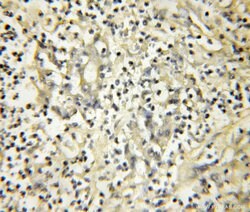NXT2 Rabbit anti-Human, Mouse, Rat, Polyclonal, Proteintech:Antibodies:Primary