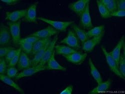 GAK Rabbit anti-Human, Mouse, Rat, Polyclonal, Proteintech 150 &mu;L; Unconjugated:Antibodies,