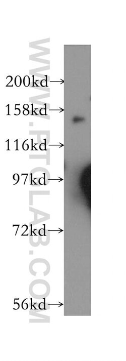 GAK Rabbit anti-Human, Mouse, Rat, Polyclonal, Proteintech 150 &mu;L; Unconjugated:Antibodies,
