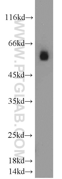 LMBR1L Rabbit anti-Human, Mouse, Rat, Polyclonal, Proteintech 20 &mu;L | Buy Online | Proteintech | Fisher Scientific