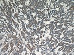 Thumbnail_Dysadherin Rabbit anti-Human, Mouse, Polyclonal, Proteintech:Anticorps:Anticorps