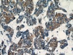 Thumbnail_Dysadherin Rabbit anti-Human, Mouse, Polyclonal, Proteintech:Anticorps:Anticorps