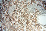 Thumbnail_Dysadherin Rabbit anti-Human, Mouse, Polyclonal, Proteintech:Anticorps:Anticorps