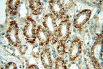 Thumbnail_Dysadherin Rabbit anti-Human, Mouse, Polyclonal, Proteintech:Anticorps:Anticorps