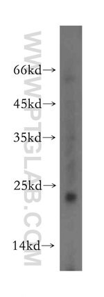 Thumbnail_Dysadherin Rabbit anti-Human, Mouse, Polyclonal, Proteintech:Anticorps:Anticorps
