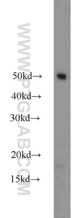 Thumbnail_Dysadherin Rabbit anti-Human, Mouse, Polyclonal, Proteintech:Anticorps:Anticorps